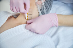 Imagene haciendo referencia la rocediimiento de Lifting de cuello con la Dr Grecia 